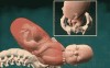 foetus accouchement naissance et puis j'avais décidé de sortir un peu.gif, janv. 2023