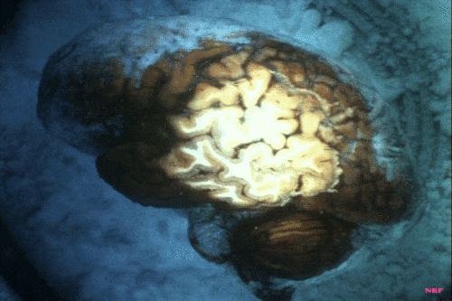 Encyclopedia Britannica Films The Human Brain, 1955 cerveau.gif, mar. 2021