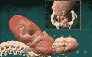 foetus accouchement naissance et puis j'avais décidé de sortir un peu.gif, janv. 2023