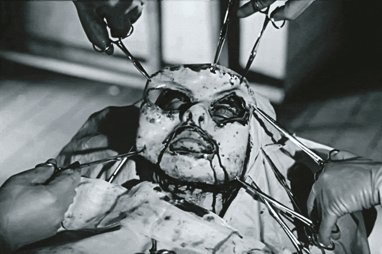 Les yeux sans visage (1960) Georges Franju quel déguisement pour Halloween chirurgie