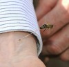 dard piqure d'abeille.jpg
