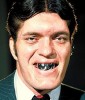 sourire_dents_metal.jpg