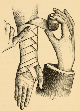 The roller bandage applied to the arm.” Advanced lessons in physiology and hygiene. 1895 secourisme bandage quand je pense à Fernande.png, sept. 2020
