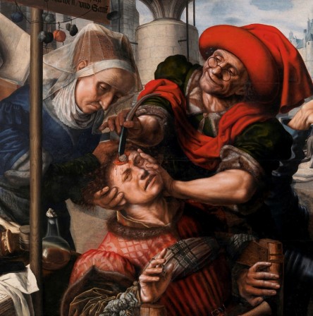 Jan Sanders van Hemessen extraction de la pierre de folie 1555 musée du Prado trépanation.jpg, oct. 2020