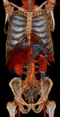 Volume Rendering CT scans by voxel123 anatomie les couleurs intérieures.jpg, mar. 2021