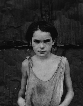 Dorothea Lange Damaged Child Shacktown Elm Grove Oklahoma 1936.jpg