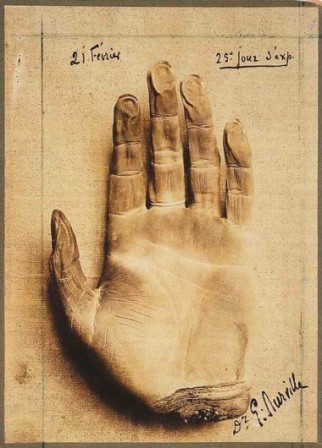 Gaston_Durville_Hand_of_a_Corpse_Mummified_by_Mesmerism_1913_la_main_de_la_momie.jpg