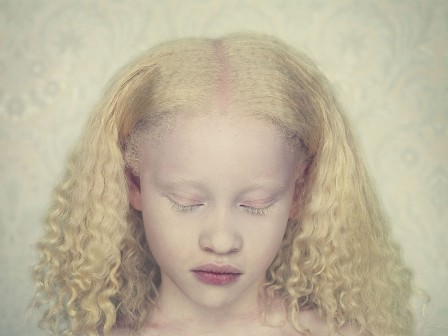 Gustavo Lacerda albinos les cils blonds.jpg