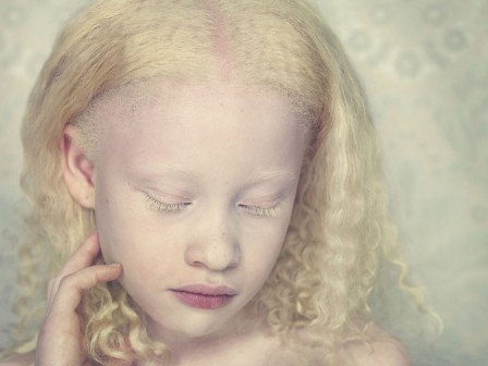 Gustavo_Lacerda_fille_noire_albinos_anniversaire.jpg