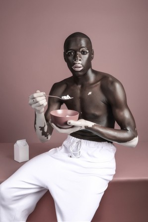 Justin Dingwall vitiligo petit déjeuner.jpg