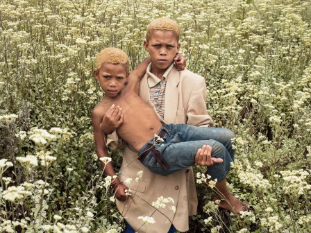 Pieter Hugo albinos blonds lives matter.jpg, juin 2020
