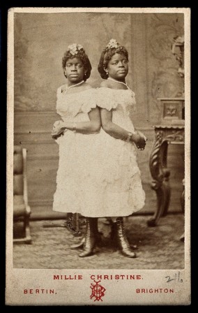The Millie-Christine sisters conjoined twins standing Photograph by Bertin c. 1874 jumelles siamoises noires.jpg, déc. 2023