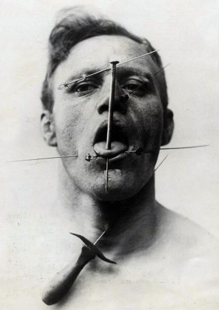 Vintage Photos of Circus Performers from 1890s-1910s cirque vaccin injection.jpg, déc. 2021