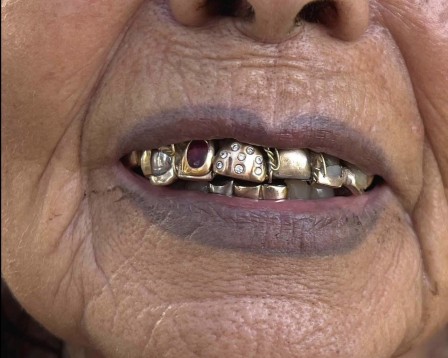 Michèle Lamy bonjour les prothésistes dentaires.jpg, janv. 2024